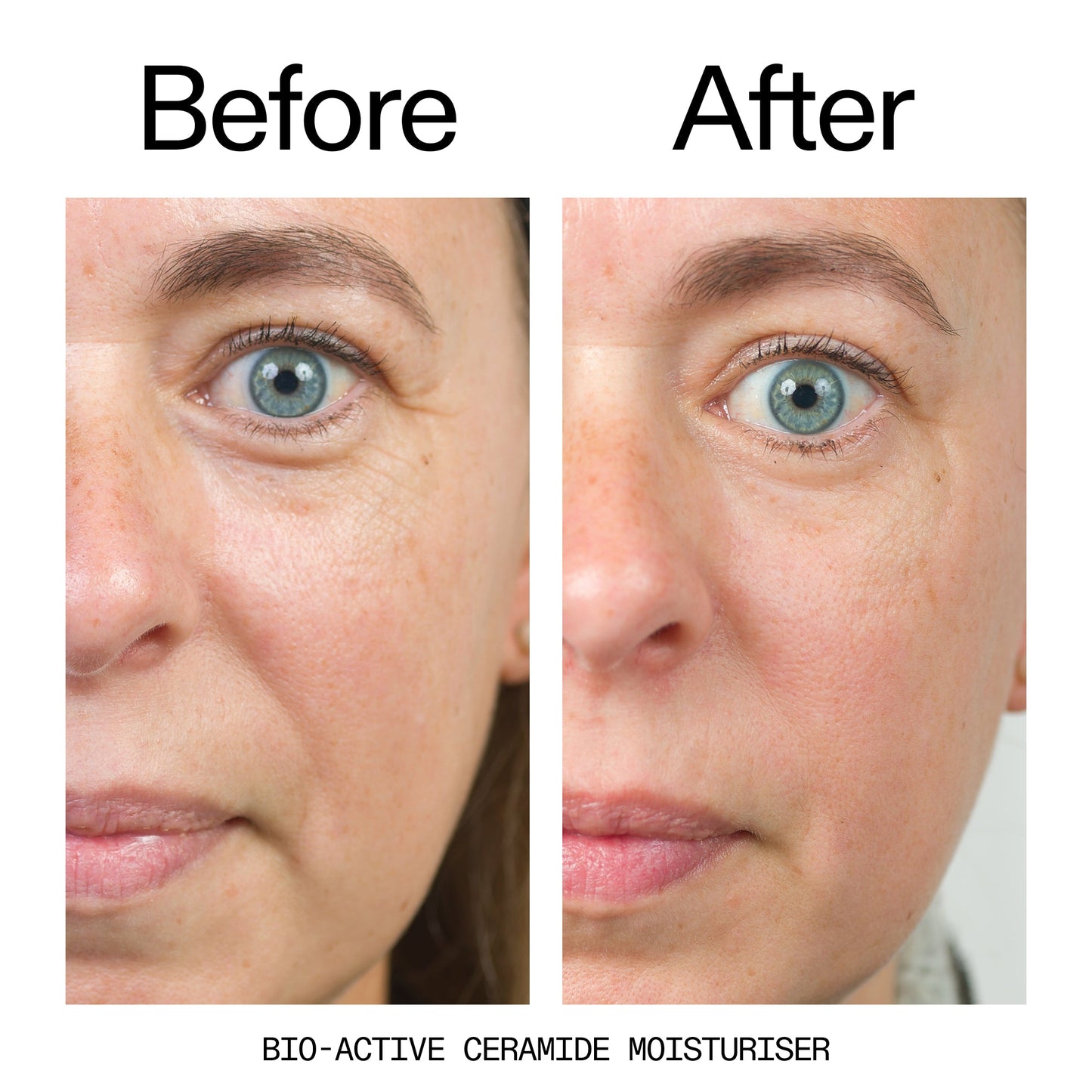 barrier-boosting-trio-o9 Bio-Active_Before_After_2000x2000_600947b4-e8c5-425a-9155-fc15bc83aa12.jpg