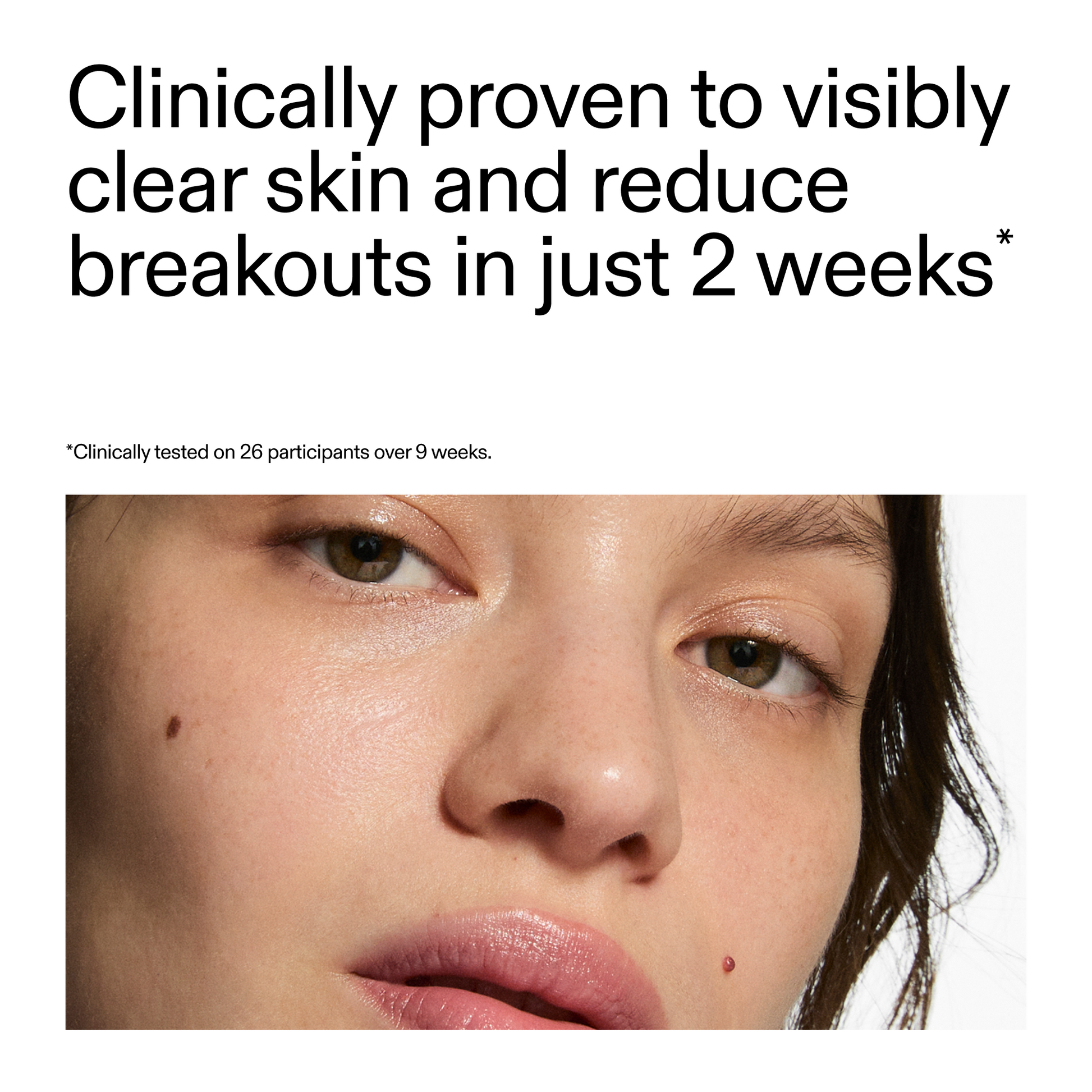 360-acne-clearing-duo-r0 360_Serum_Key_Claim.png