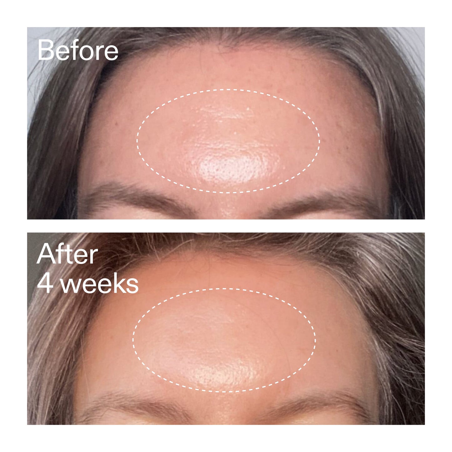 advanced-0-2-retinal-serum-w2 AdvancedRetinal_BeforeAfter1_2000x2000_1da6bb0a-29dd-41d1-95b7-8679696bbf0f.jpg