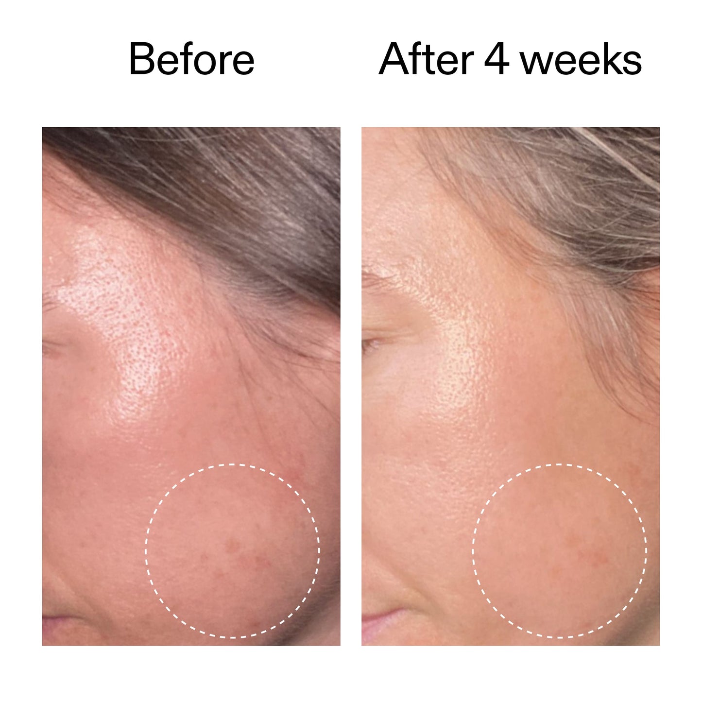 advanced-0-2-retinal-serum-w2 AdvancedRetinal_BeforeAfter2__2000x2000_62fb16bb-77ae-4d63-8500-88dbf847f4b9.jpg