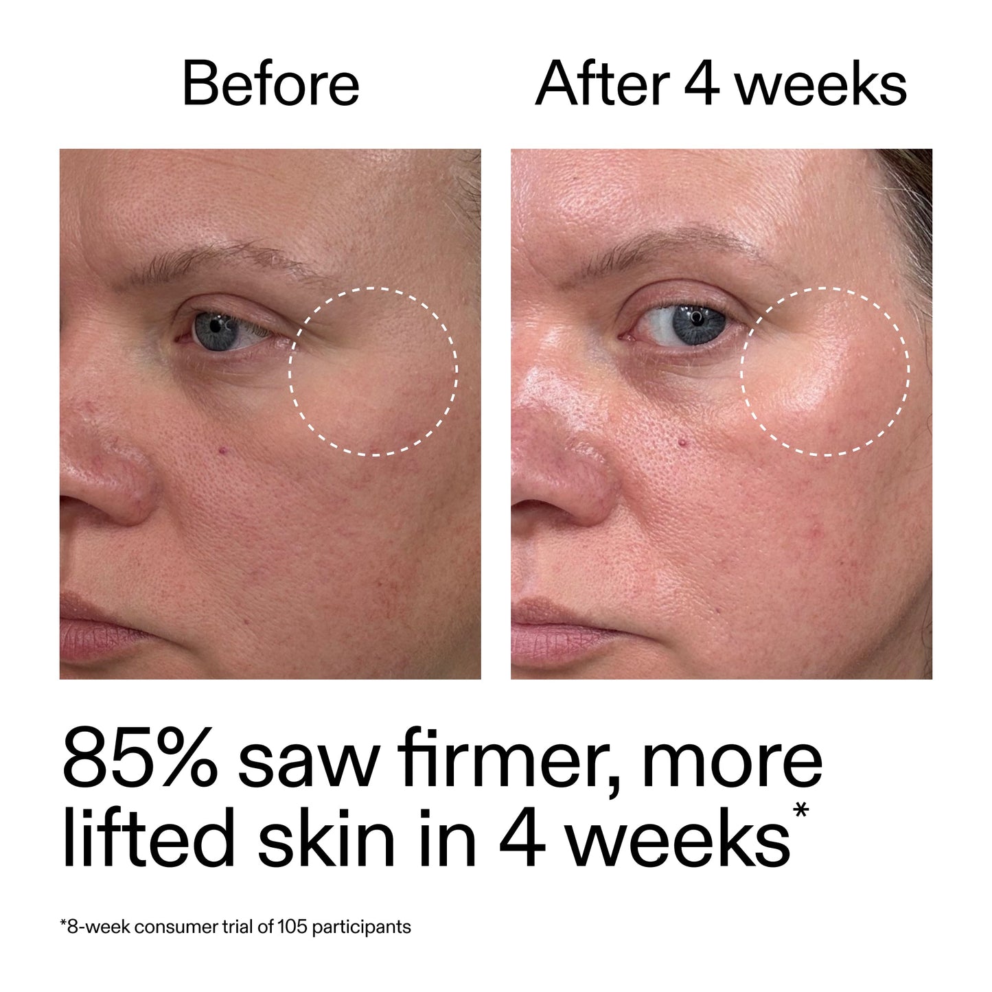 advanced-0-2-retinal-serum-duo-a0 AdvancedRetinal_BeforeAfter_Claim1_2000x2000_3a315aa8-f408-4b33-bbeb-0d9209f98404.jpg