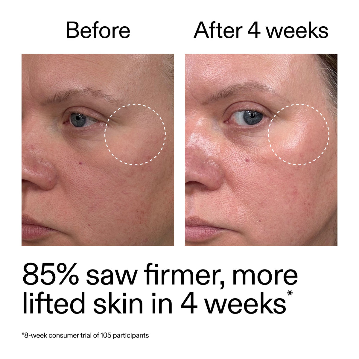 advanced-0-2-retinal-serum-duo-a0 AdvancedRetinal_BeforeAfter_Claim1_2000x2000_3a315aa8-f408-4b33-bbeb-0d9209f98404.jpg