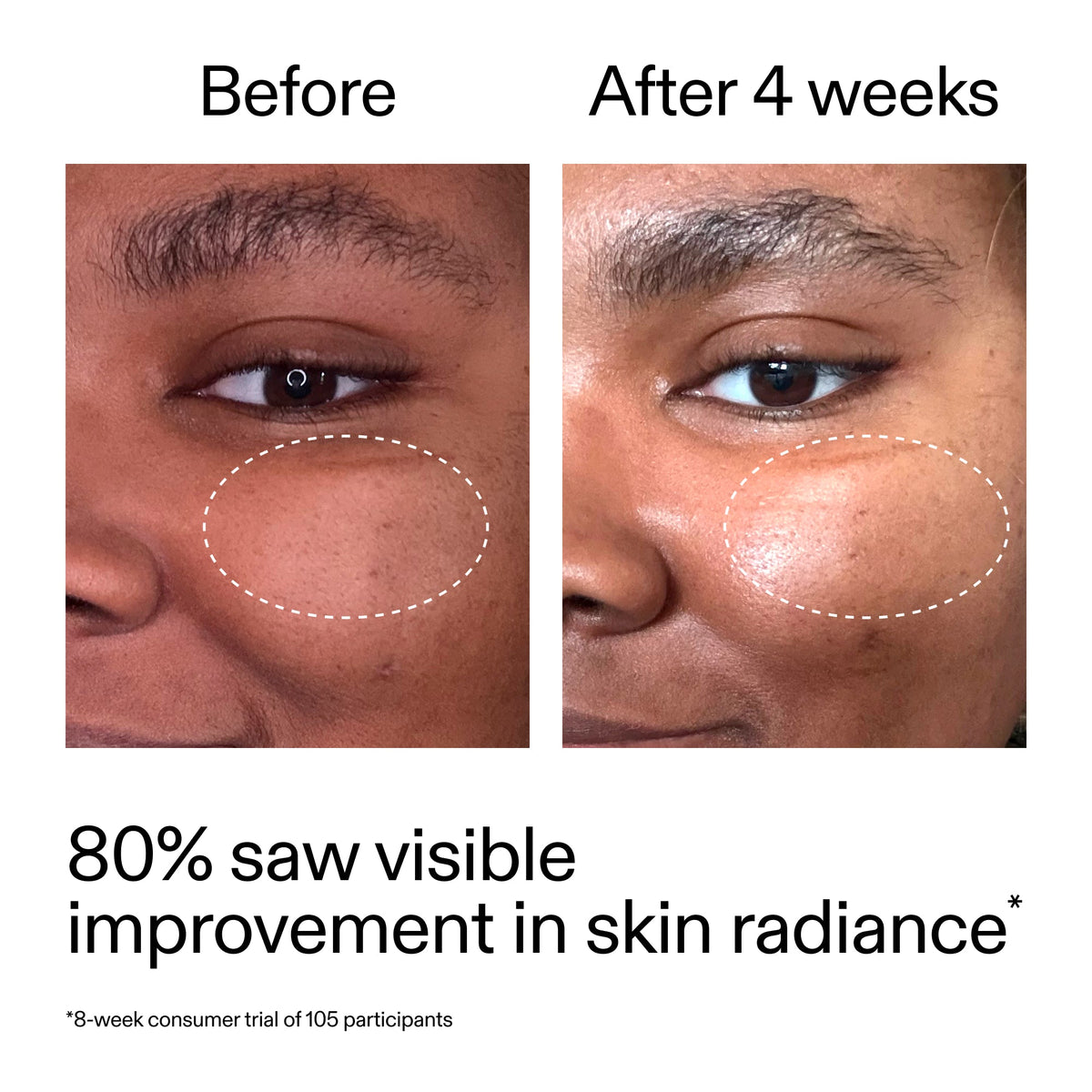 advanced-0-2-retinal-serum-w2 AdvancedRetinal_BeforeAfter_Claim2_2000x2000_39d11e3d-eda9-44ec-ab32-2903b1a368bd.jpg