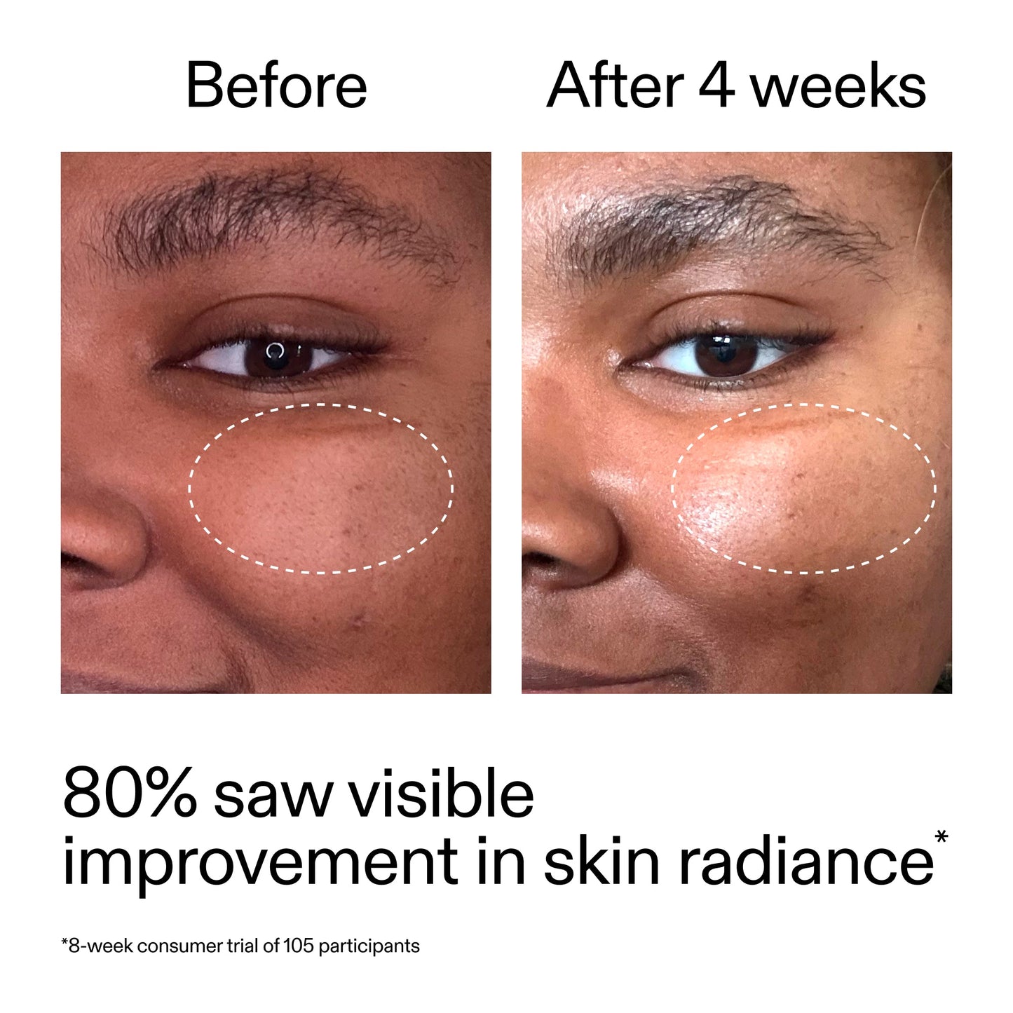 advanced-0-2-retinal-serum-duo-a0 AdvancedRetinal_BeforeAfter_Claim2_2000x2000_681b621d-8d44-4d44-9a40-89244f9b2e53.jpg