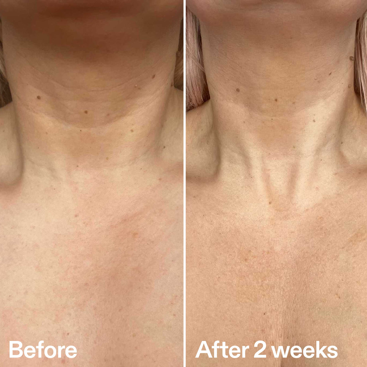 bio-active-neck-lift-stick-h5 B_A_2.jpg