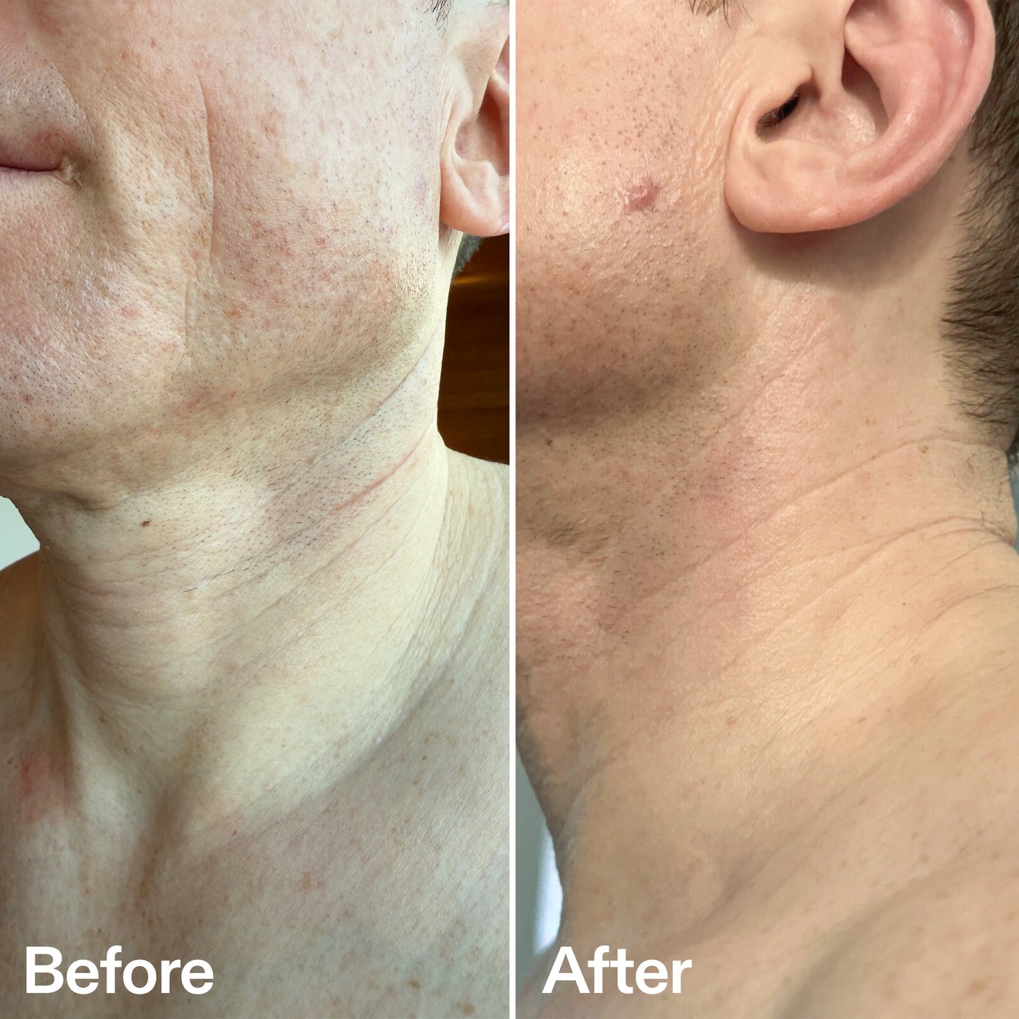 bio-active-neck-lift-stick-h5 B_A_afa2743e-b8e2-4504-92f4-e281cb6cf759.jpg