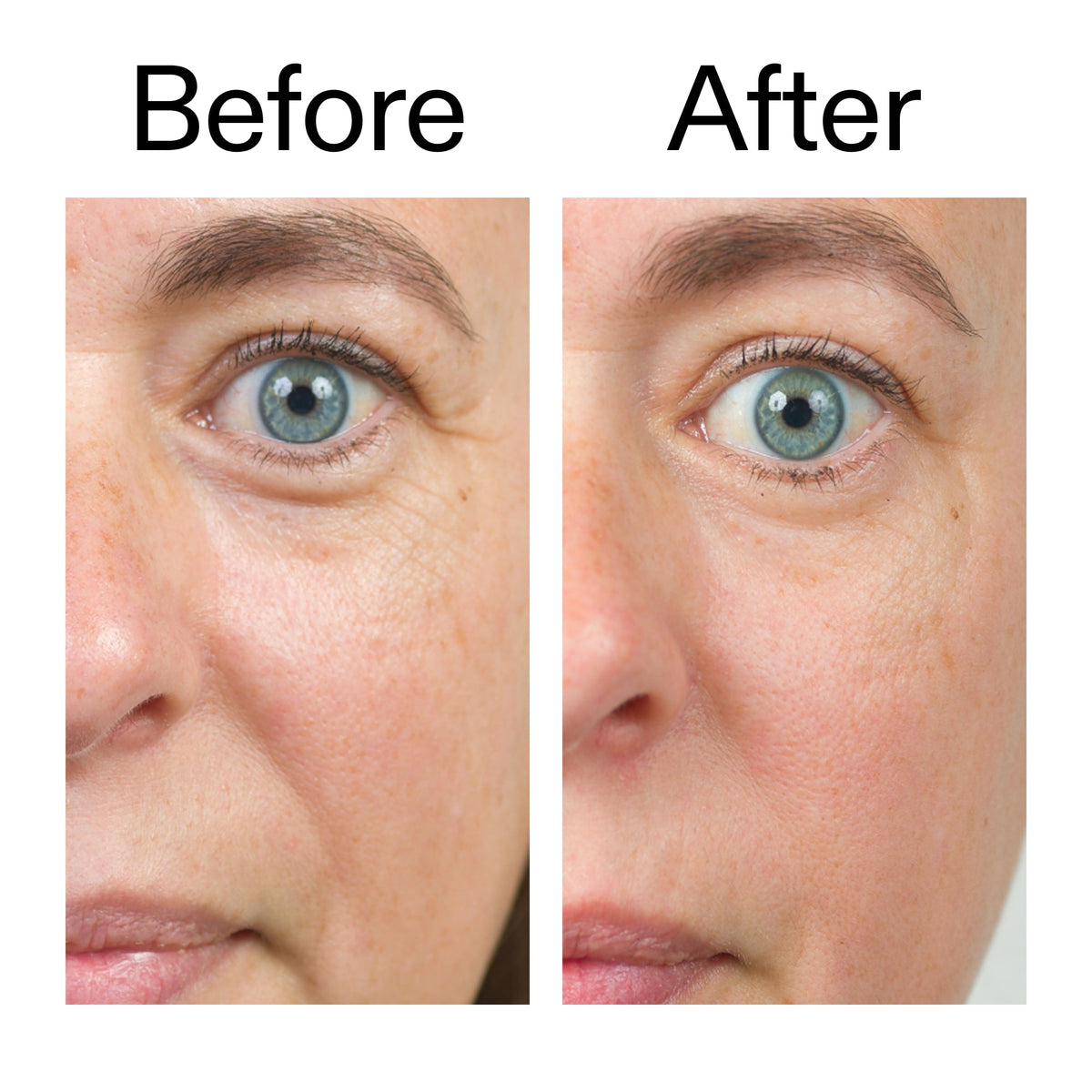 bio-active-ceramide-moisturizer-i6 Bio-Active_Before_After_2000x2000_566e5a9e-135e-417a-8242-b44e5fa35463.jpg