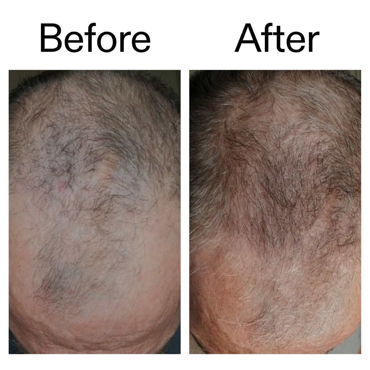 caffeine-stimulating-scalp-treatment-i0 Caffeine_Scalp_Treatment_B_A_Ppage_2000_x_2000.jpg