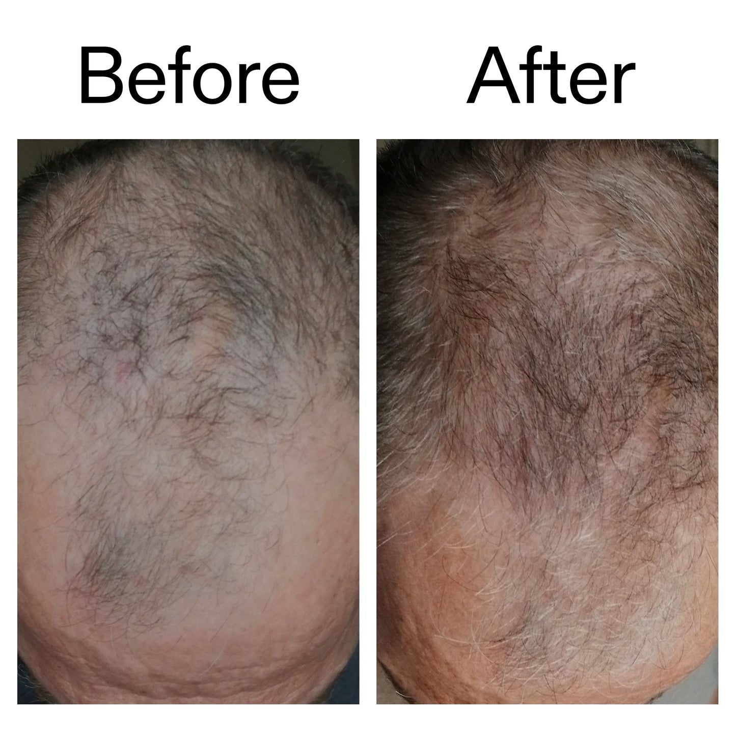 3-month-hair-growth-trio-k9 Caffeine_Scalp_Treatment_B_A_Ppage_2000_x_2000.jpg