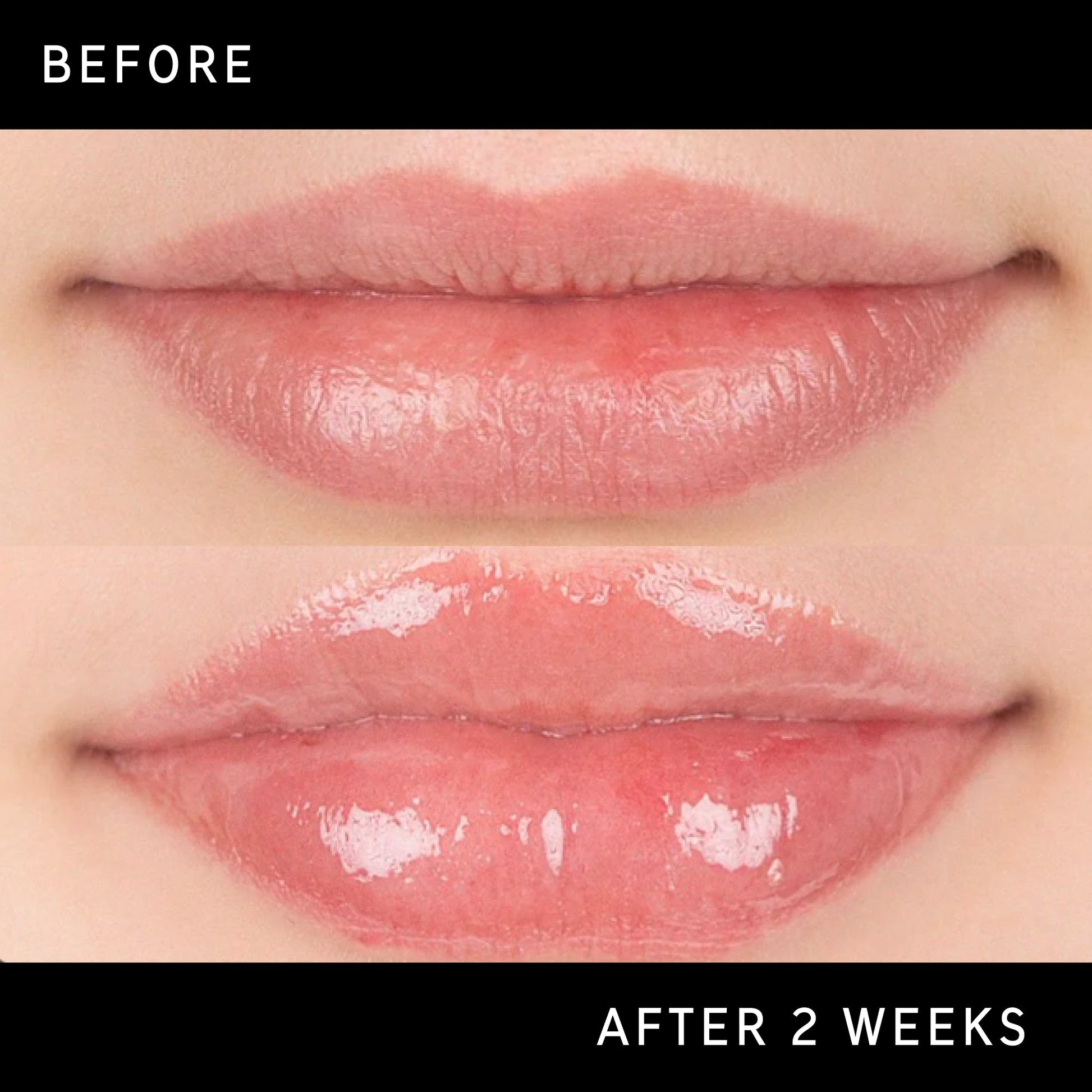lip-plumping-duo-j8 DTC-Top15_Amends_Tripeptide-Lip_B_A.jpg