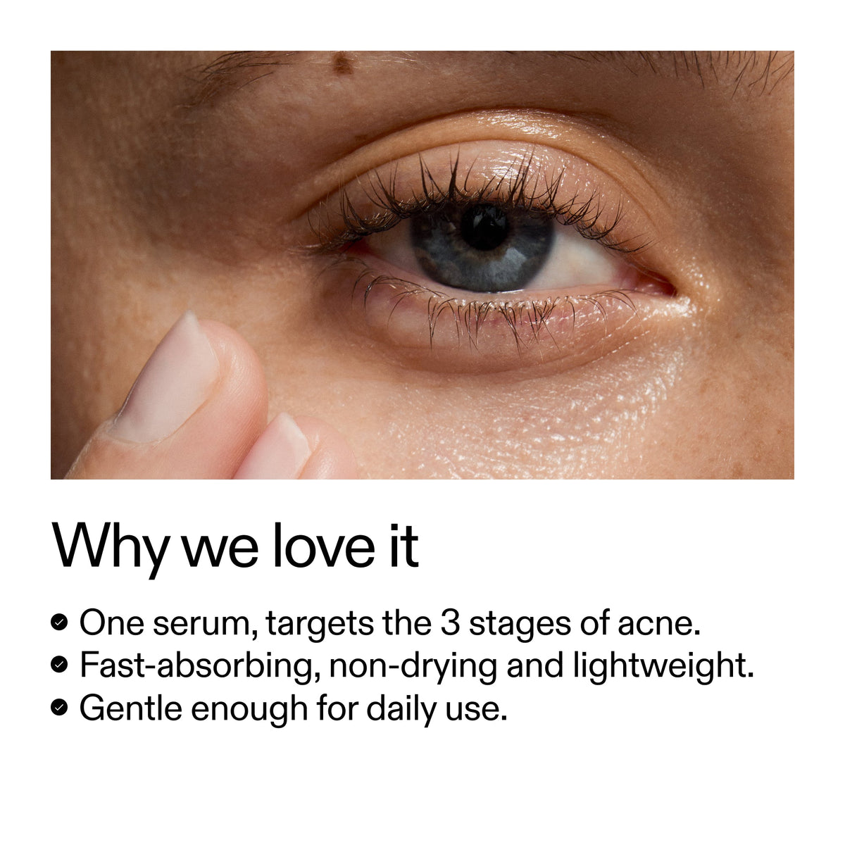 360-acne-clearing-duo-r0 Dioic_Whyweloveit_2000x2000_175aafd3-0cbe-403a-b317-a8362881bfe2.jpg