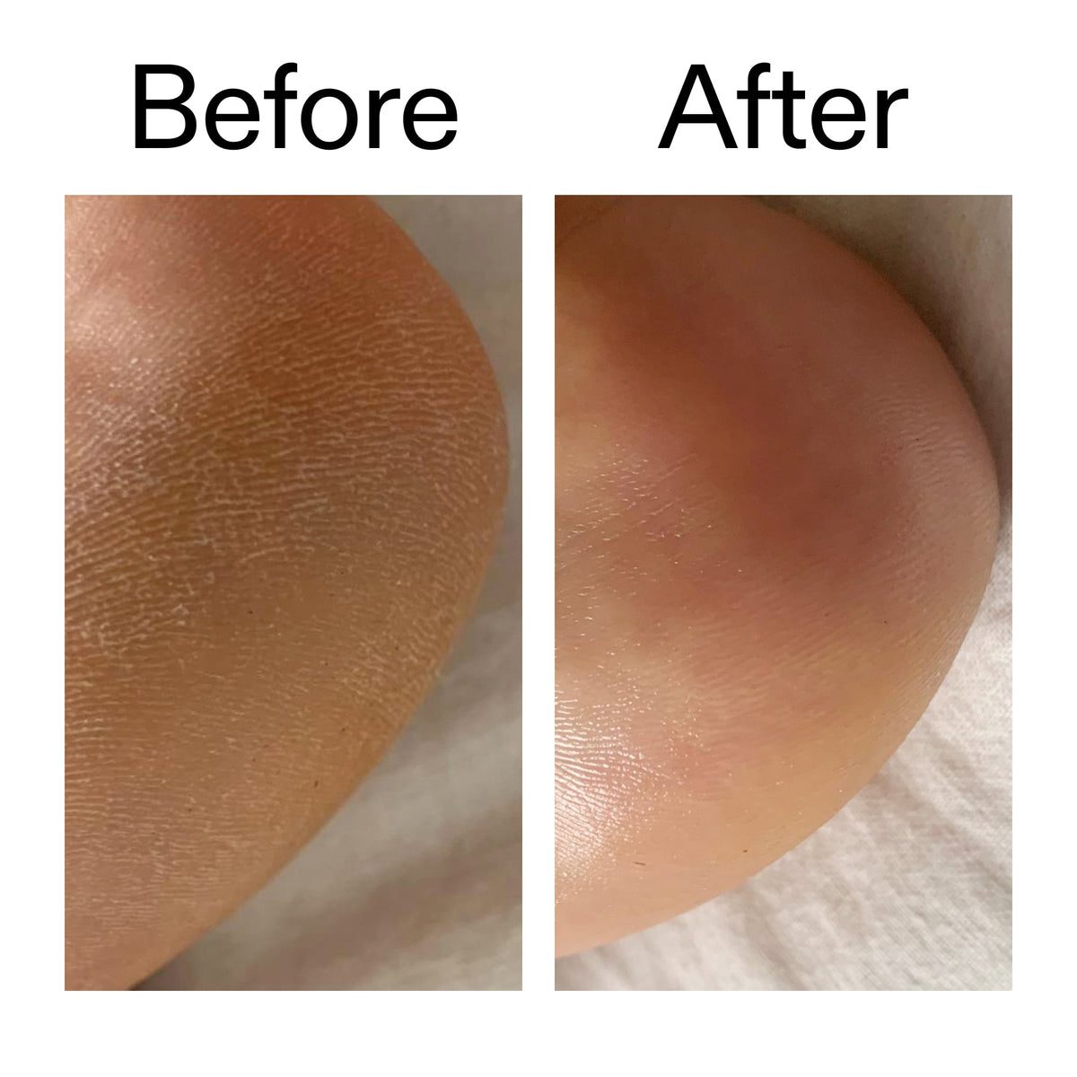 glycolic-acid-exfoliating-body-stick-u8 Glycolic_Acid_Exfoliating_Body_Stick_Before_After_V1_2000x2000_a3043625-9400-429a-a7fb-d6dbd220f722.jpg