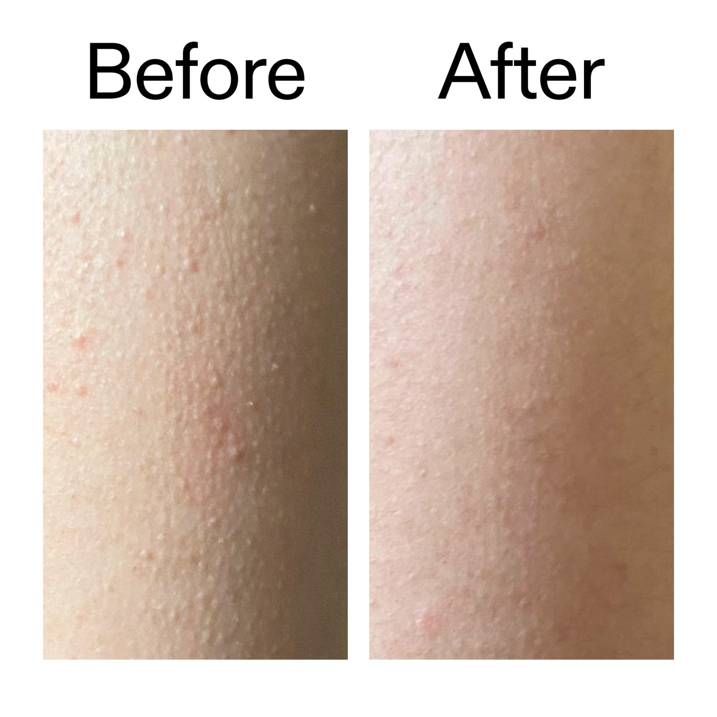 glycolic-acid-exfoliating-body-stick-u8 Glycolic_Acid_Exfoliating_Body_Stick_Before_After_V2_2000x2000_2e4ba052-94f6-4d56-82df-7bdb5b2df7ae.jpg
