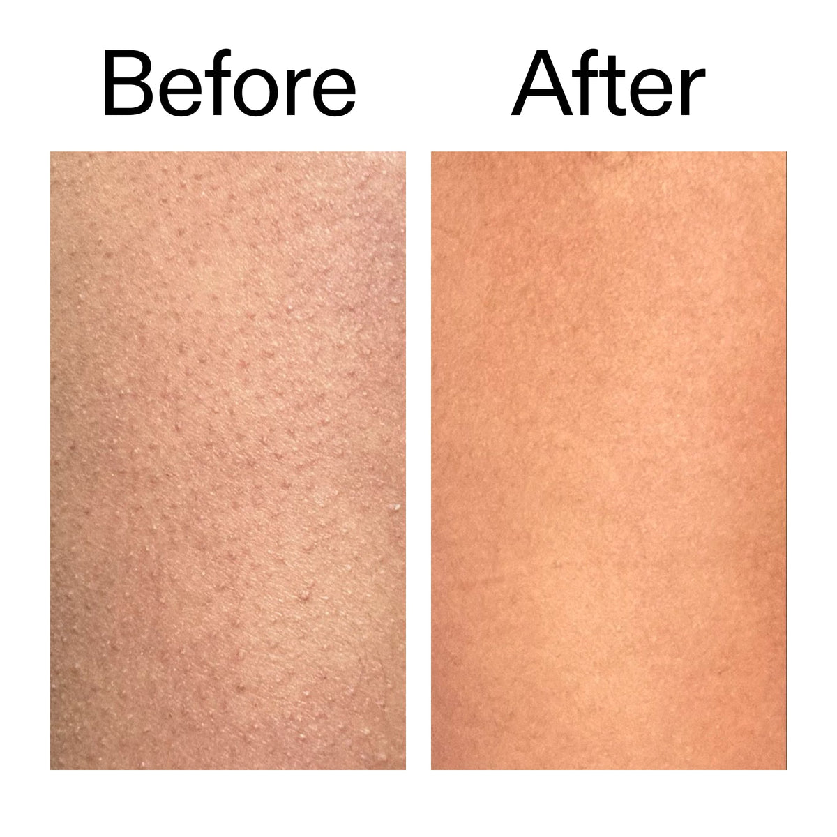glycolic-acid-exfoliating-body-stick-u8 Glycolic_Body_Stick_B_A_2000x2000_6e6e6b4d-5bd7-43c0-aeed-4d66788e8995.jpg
