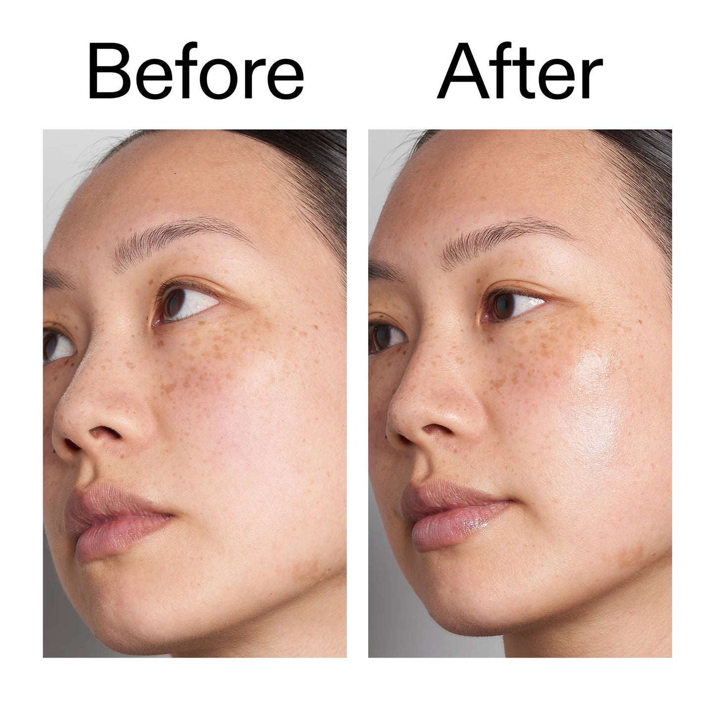 hyaluronic-acid-serum-60ml-e1 Hyaluronic_Acid_Before_After_2000x2000_d7983956-8aa2-4ea3-8255-c63e8d4f892e.jpg
