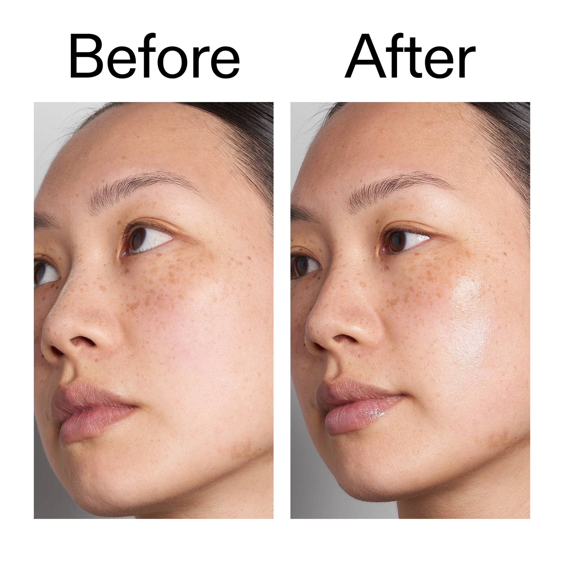 supersize-hyaluronic-acid-serum-100ml-duo-k3 Hyaluronic_Acid_Before_After_2000x2000_d7983956-8aa2-4ea3-8255-c63e8d4f892e.jpg