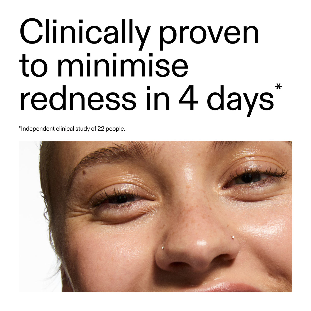 10-azelaic-acid-serum-for-redness-relief-f9 Oat_Cleansing_Balm_Claim_2000x2000_52a841dc-353c-4f2c-8646-3aadb604507d.jpg