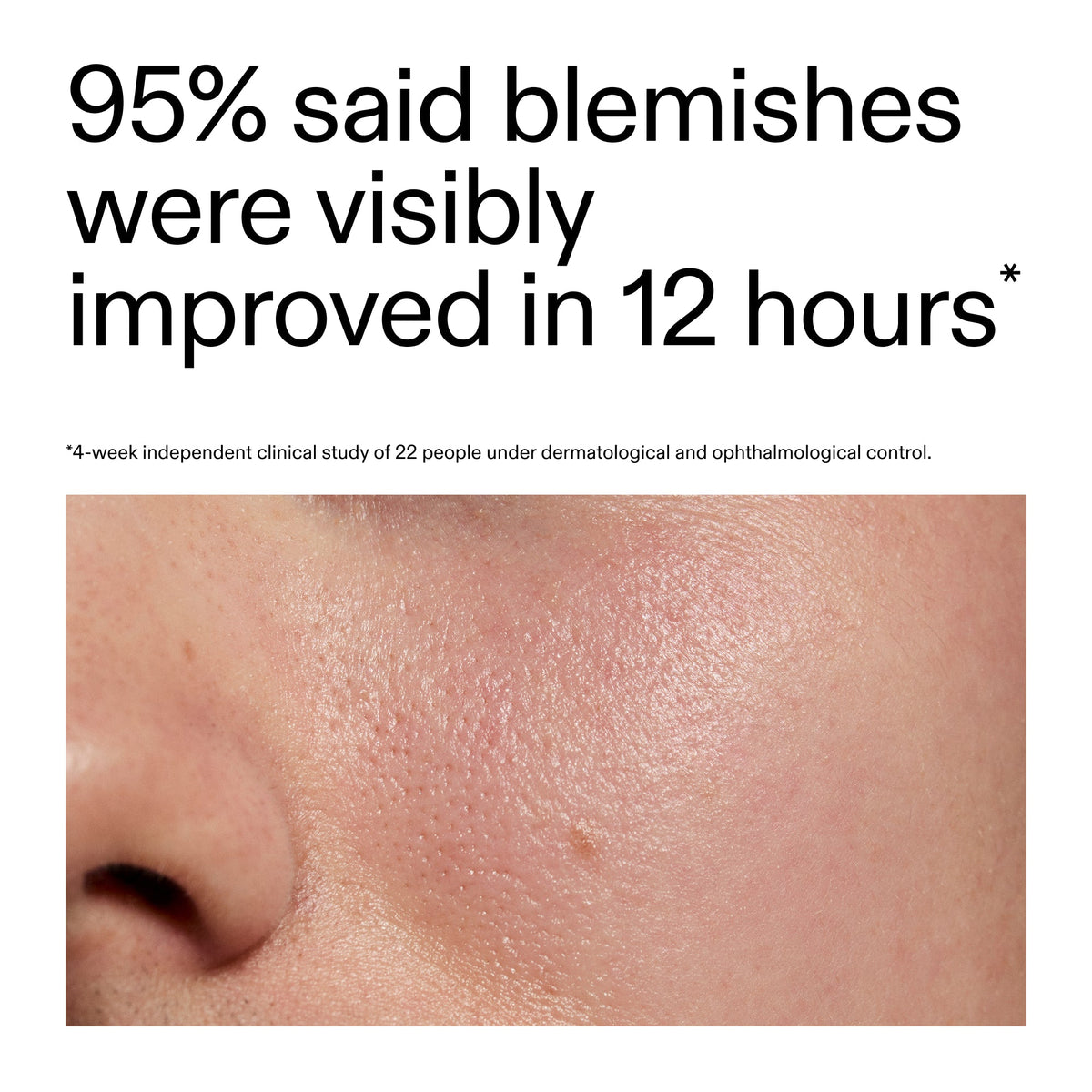 succinic-acid-acne-treatment-j5 Oat_Cleansing_Balm_Claim_2000x2000_ac6ce553-25db-41b2-a981-faae1ac4b8c0.jpg