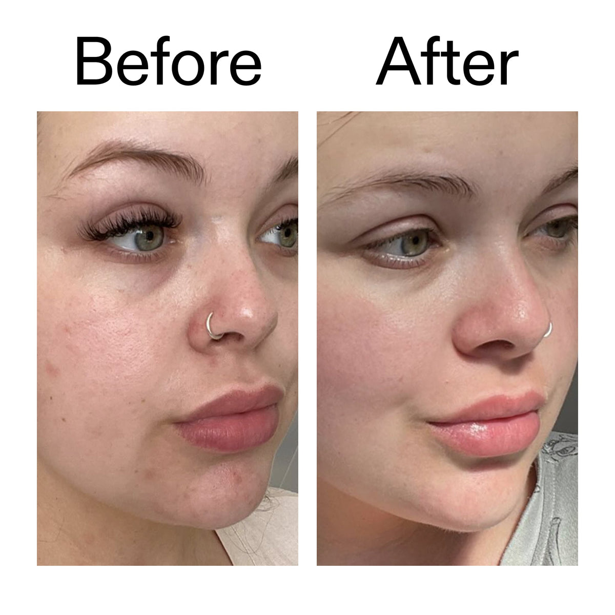 supersize-omega-water-cream-100ml-a2 Omega50_Before_After_2000x2000_46483ed8-3f9d-487f-9a0c-9df79830bd65.jpg