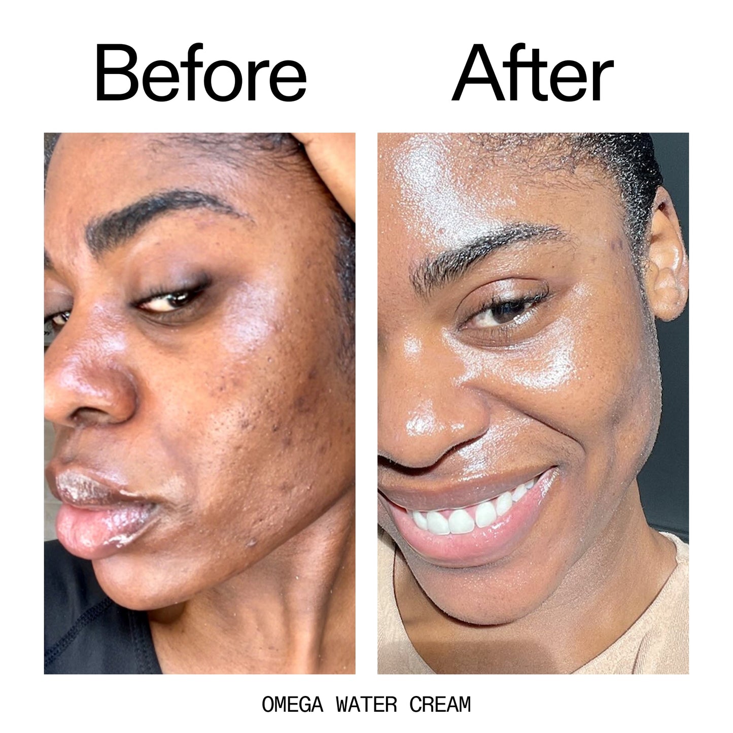 glowing-skin-set-a3 Omega_Water_Cream_Before_After_2000x2000_8e88278b-8c8d-48dc-ac77-4e98ebbd1b77.jpg