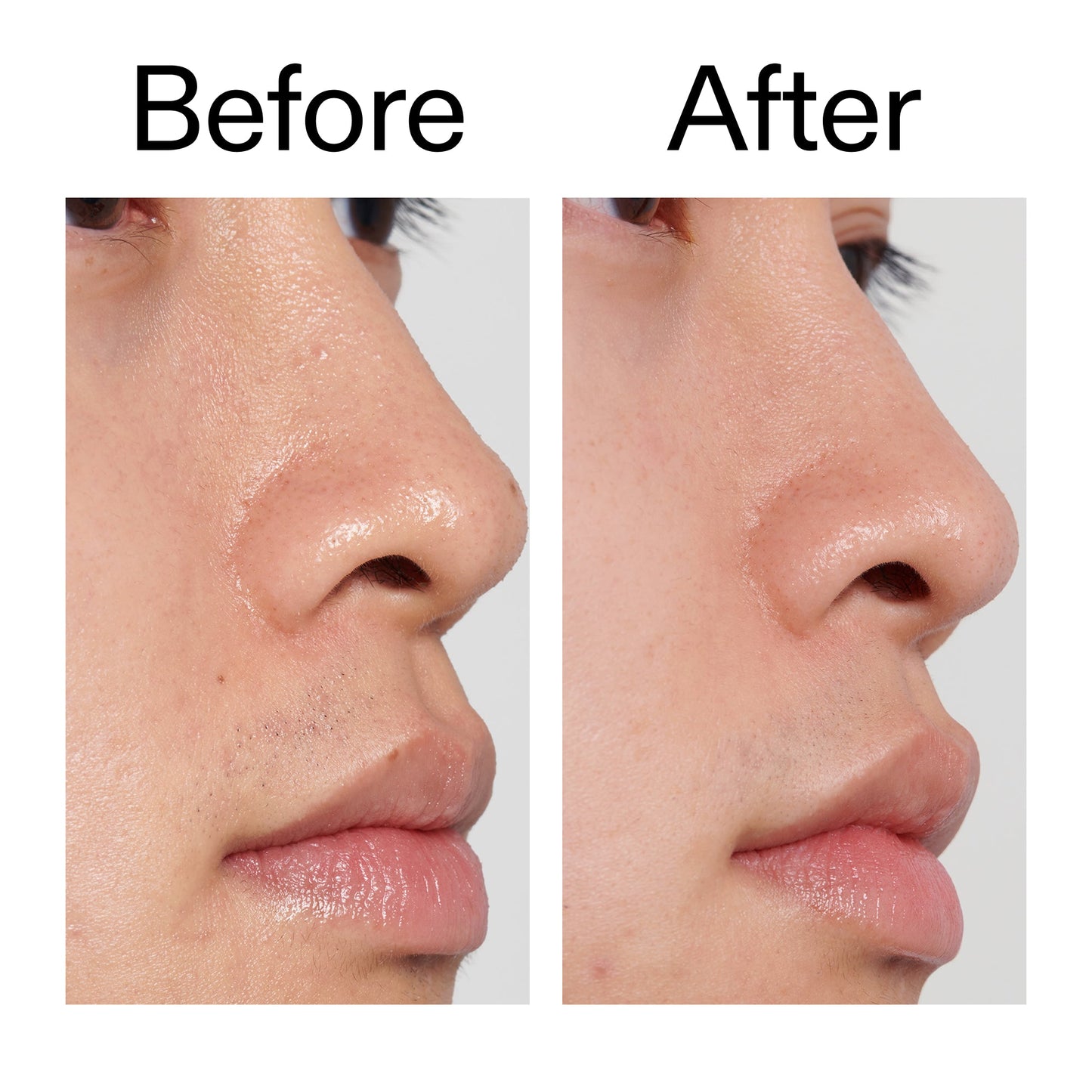 pha-toner-r2 PHA_Toner_Before_After_2000x2000_e3c10172-0150-4342-8b95-57417eaff50d.jpg