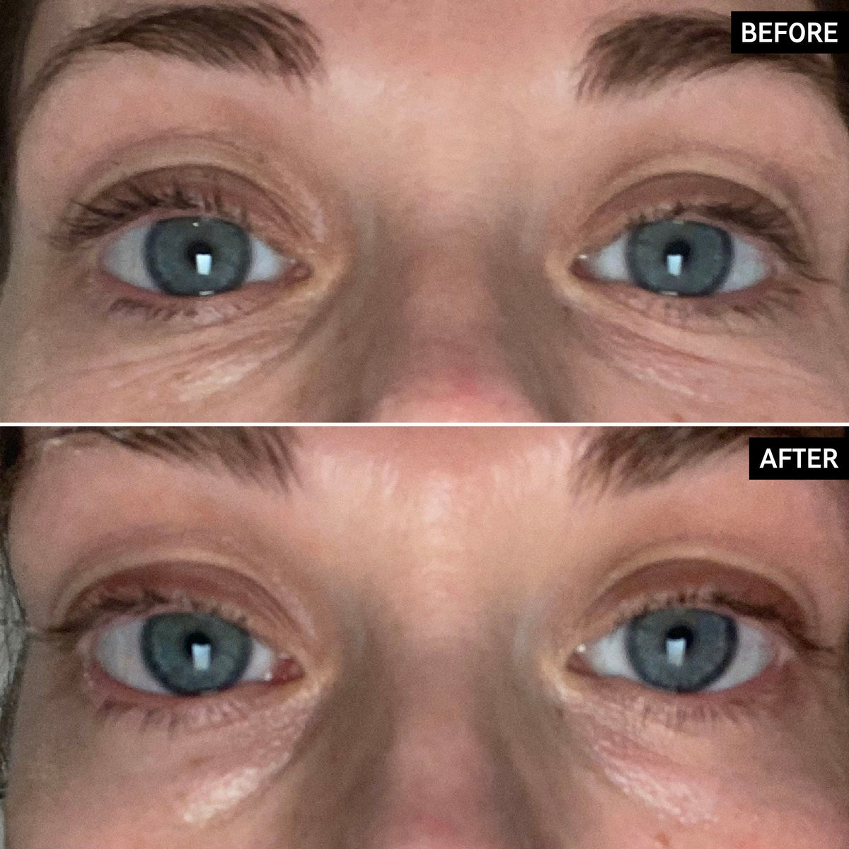 retinol-eye-cream-e0 SITE-UGCBAsApril_Nicole_B_A_PPage_2000x2000_1.jpg