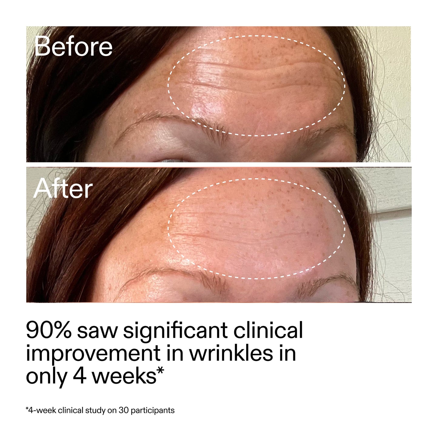 starter-retinol-serum-duo-x3 StarterRetinol_BeforeAfter_Claim1_2000x2000_03b4d6e5-a357-43b9-a855-aba5e35c57f3.jpg
