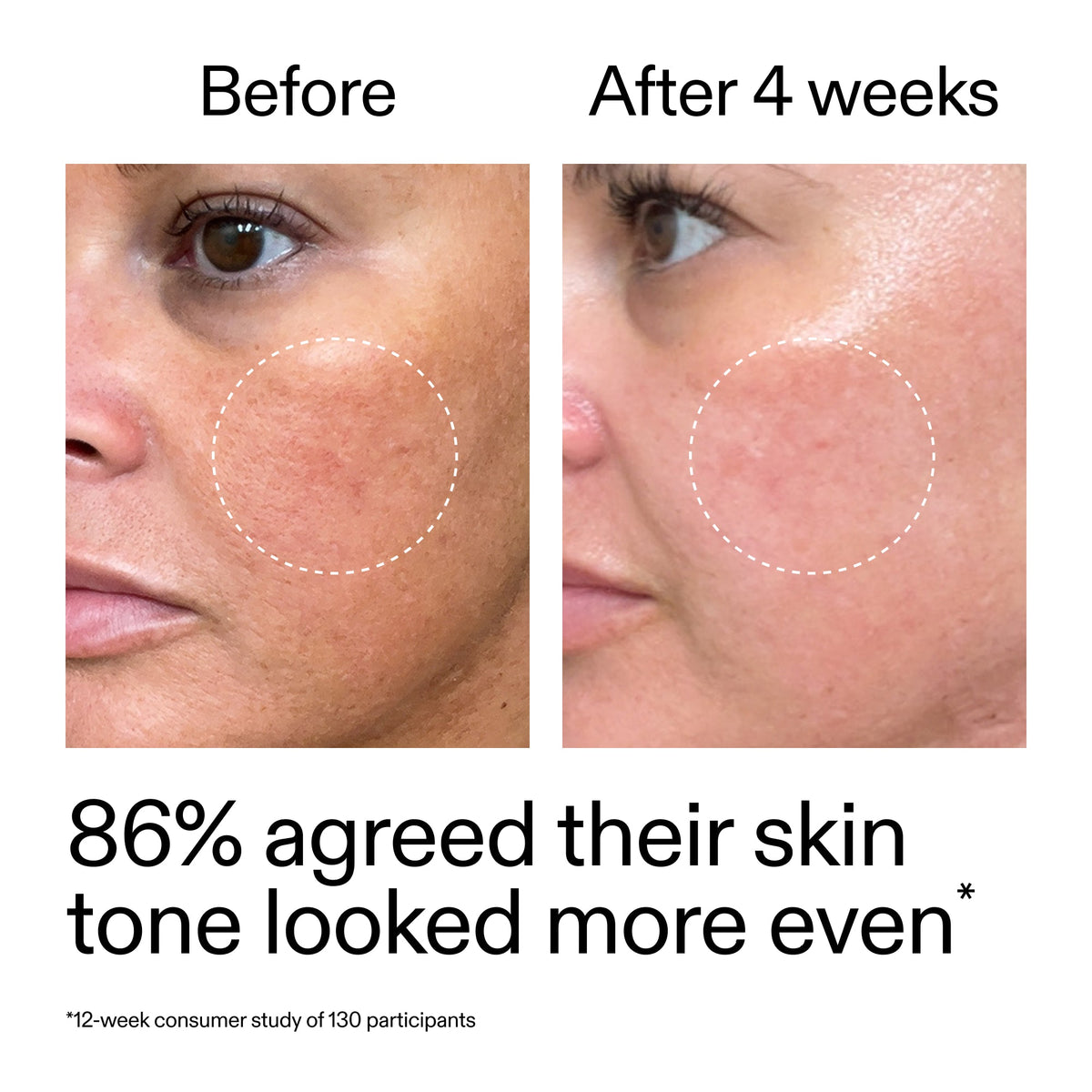 starter-retinol-serum-duo-x3 StarterRetinol_BeforeAfter_Claim2_2000x2000_fc5bb8ac-8588-478f-98d5-28af6651601a.jpg