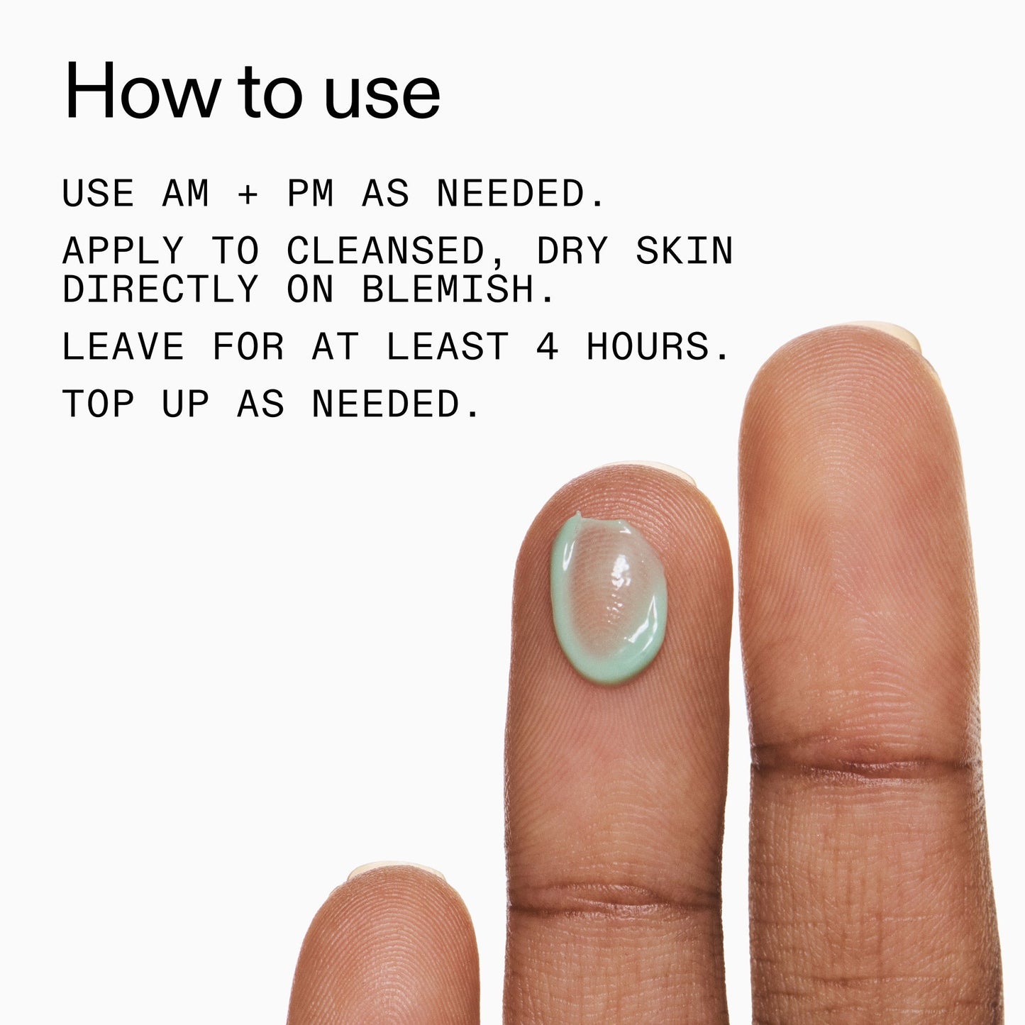 succinic-acid-acne-treatment-j5 Succinic_Acid_Treatment_How_to_Use_2000x2000_d57137d5-d7f1-427c-9a46-5fc00c19c542.jpg